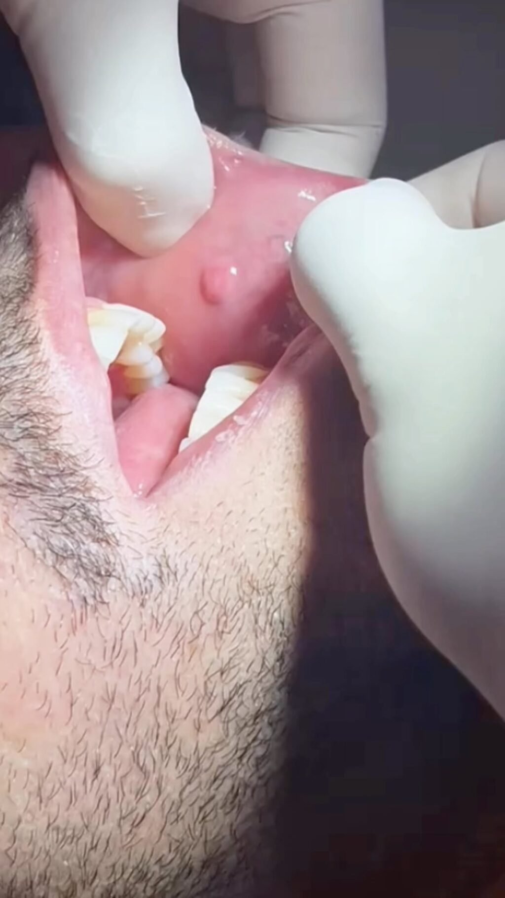 Instagram post from cirurgiaodanielsantana. This post is in position 7.