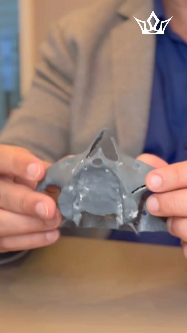 Instagram post from cirurgiaodanielsantana. This post is in position 1.